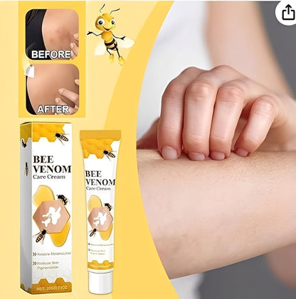 Fivfivgo Vitigo Bee Venom Correcting Cream 20g | Skin Tone Balancing And Pigmentation Repair Cream For Even, Healthy-Looking Skin